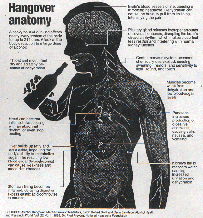 hangover anatomy